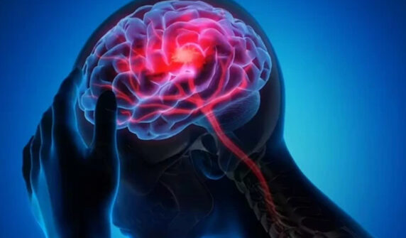 brain